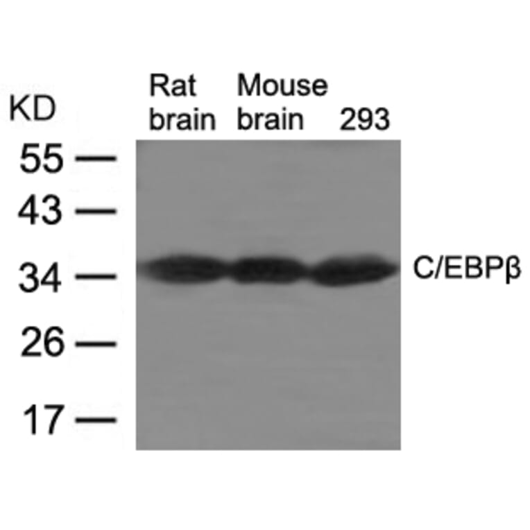 Western blot - C/EBPb Antibody from Signalway Antibody (21675) - Antibodies.com