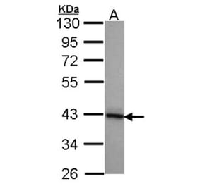 DNAJB2 antibody from Signalway Antibody (22071) - Antibodies.com