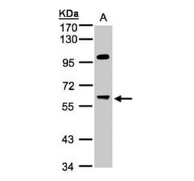 MYPT3 antibody from Signalway Antibody (22084) - Antibodies.com