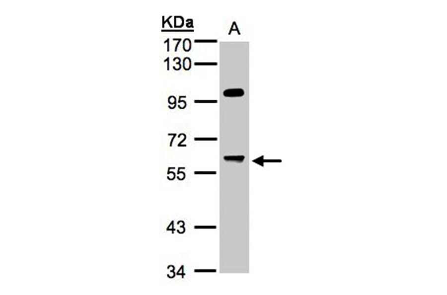 MYPT3 antibody from Signalway Antibody (22084) - Antibodies.com