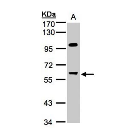 MYPT3 antibody from Signalway Antibody (22084) - Antibodies.com