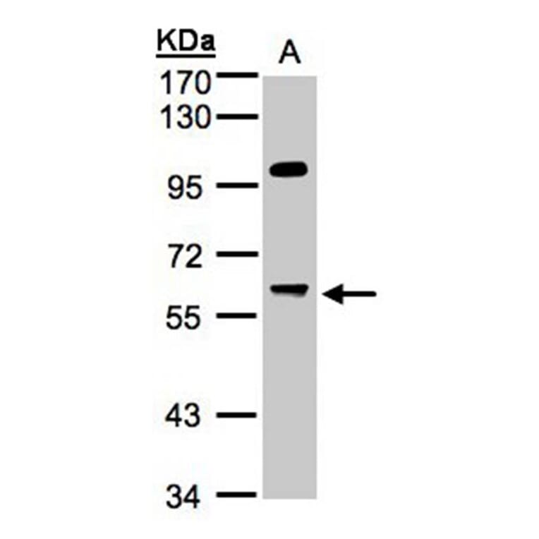 MYPT3 antibody from Signalway Antibody (22084) - Antibodies.com