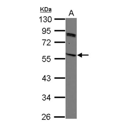 SIRPB2 antibody from Signalway Antibody (22129) - Antibodies.com