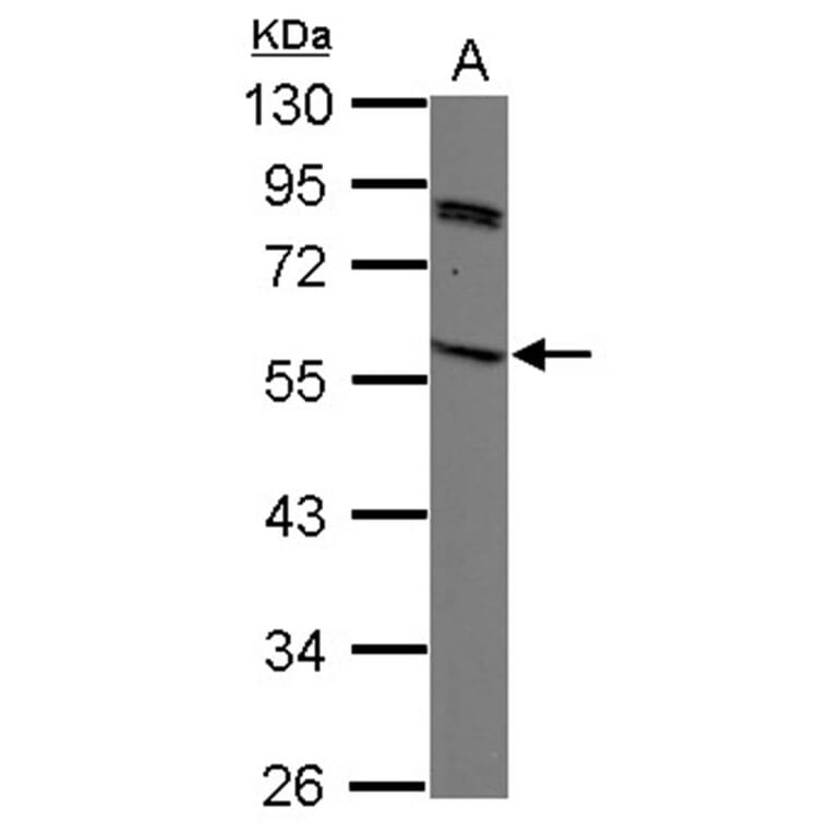 SIRPB2 antibody from Signalway Antibody (22129) - Antibodies.com