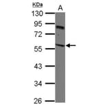 SIRPB2 antibody from Signalway Antibody (22129) - Antibodies.com
