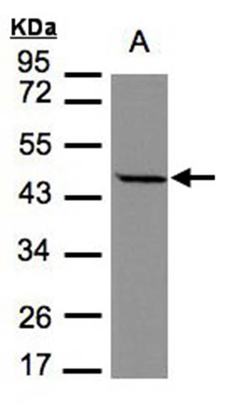 Sample (30 µg of whole cell lysate) MOLT47.5% SDS PAGE Primary antibody diluted at 1: 1000
