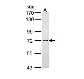 TXNDC3 antibody from Signalway Antibody (22223) - Antibodies.com