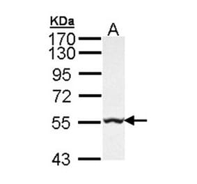 GLYCTK antibody from Signalway Antibody (22224) - Antibodies.com