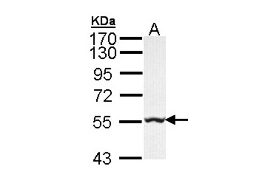 GLYCTK antibody from Signalway Antibody (22224) - Antibodies.com