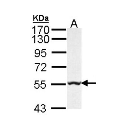 GLYCTK antibody from Signalway Antibody (22224) - Antibodies.com