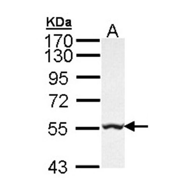 GLYCTK antibody from Signalway Antibody (22224) - Antibodies.com