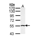 GLYCTK antibody from Signalway Antibody (22224) - Antibodies.com