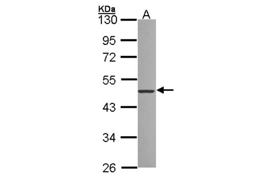 ZNF277 antibody from Signalway Antibody (22242) - Antibodies.com