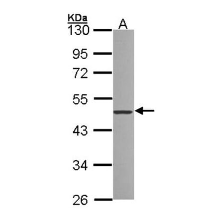 ZNF277 antibody from Signalway Antibody (22242) - Antibodies.com