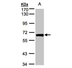 ZNF169 antibody from Signalway Antibody (22257) - Antibodies.com