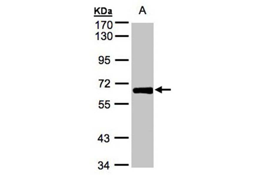 ZNF169 antibody from Signalway Antibody (22257) - Antibodies.com