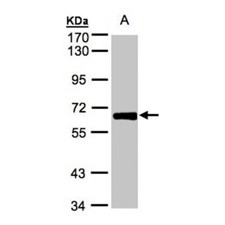 ZNF169 antibody from Signalway Antibody (22257) - Antibodies.com