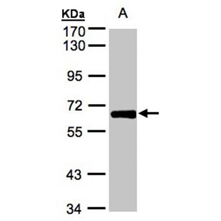 ZNF169 antibody from Signalway Antibody (22257) - Antibodies.com