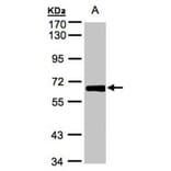 ZNF169 antibody from Signalway Antibody (22257) - Antibodies.com