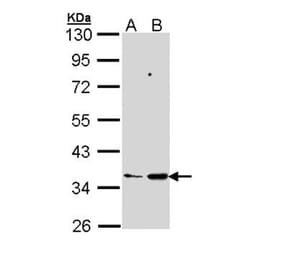 PTGES2 antibody from Signalway Antibody (22273) - Antibodies.com