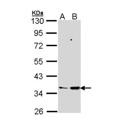 PTGES2 antibody from Signalway Antibody (22273) - Antibodies.com