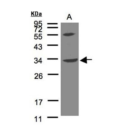 VPS37C antibody from Signalway Antibody (22312) - Antibodies.com