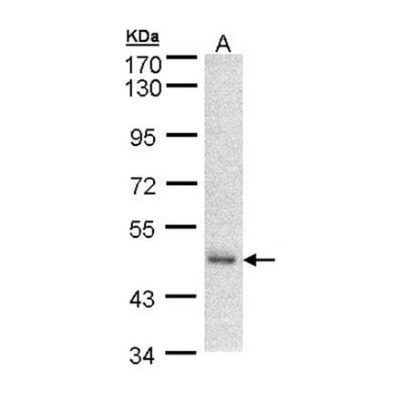 DNAJA2 antibody from Signalway Antibody (22331) - Antibodies.com