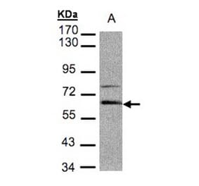 Aladin antibody from Signalway Antibody (22340) - Antibodies.com