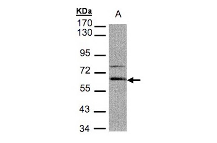 Aladin antibody from Signalway Antibody (22340) - Antibodies.com