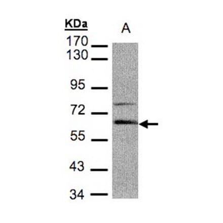 Aladin antibody from Signalway Antibody (22340) - Antibodies.com