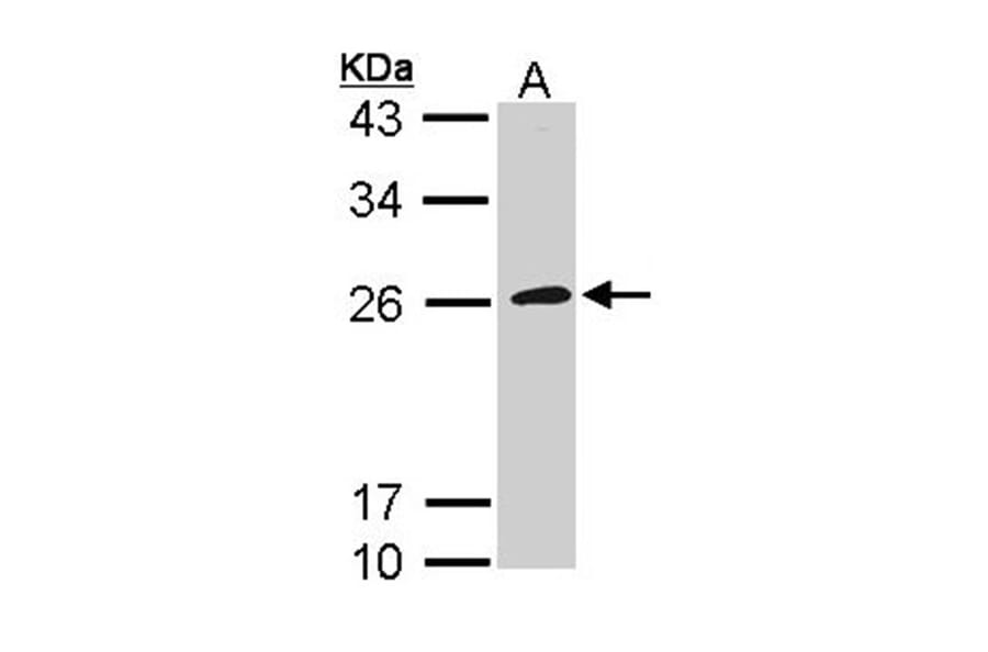 CD42c antibody from Signalway Antibody (22376) - Antibodies.com