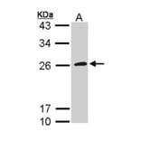 CD42c antibody from Signalway Antibody (22376) - Antibodies.com
