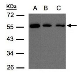 OSBPL2 antibody from Signalway Antibody (22475) - Antibodies.com