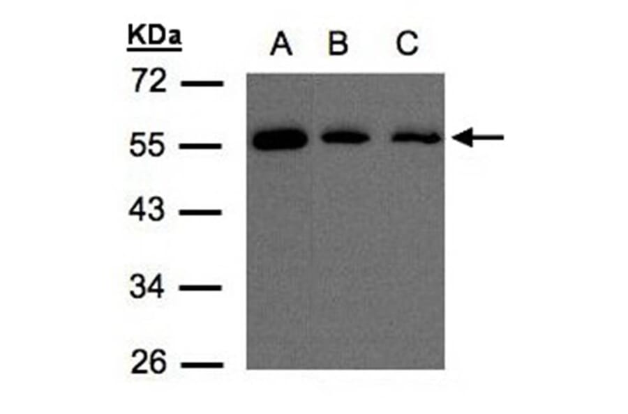 OSBPL2 antibody from Signalway Antibody (22475) - Antibodies.com
