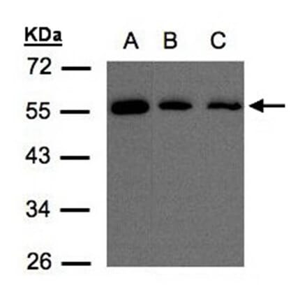 OSBPL2 antibody from Signalway Antibody (22475) - Antibodies.com