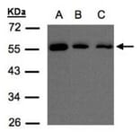 OSBPL2 antibody from Signalway Antibody (22475) - Antibodies.com