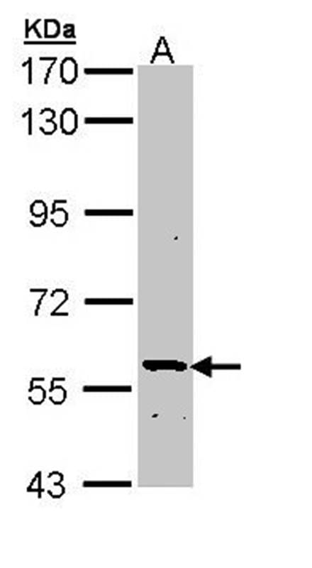 Sample (30 µg of whole cell lysate)  Molt-4 7.5% SDS PAGE Primary antibody diluted at 1: 1000