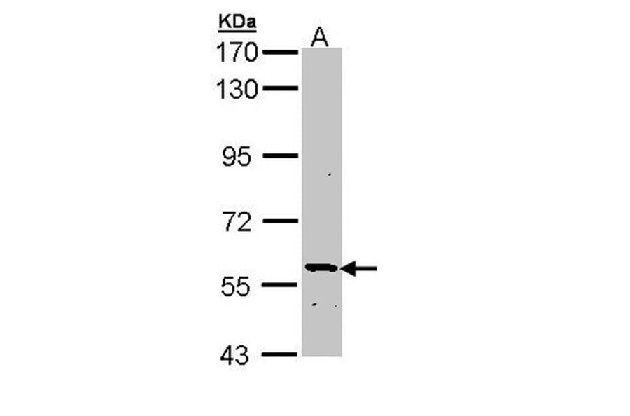 PLA2G3 antibody from Signalway Antibody (22543) - Antibodies.com