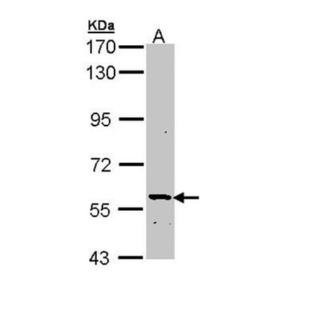 PLA2G3 antibody from Signalway Antibody (22543) - Antibodies.com