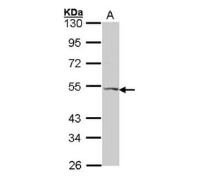 VPAC2 antibody from Signalway Antibody (22564) - Antibodies.com