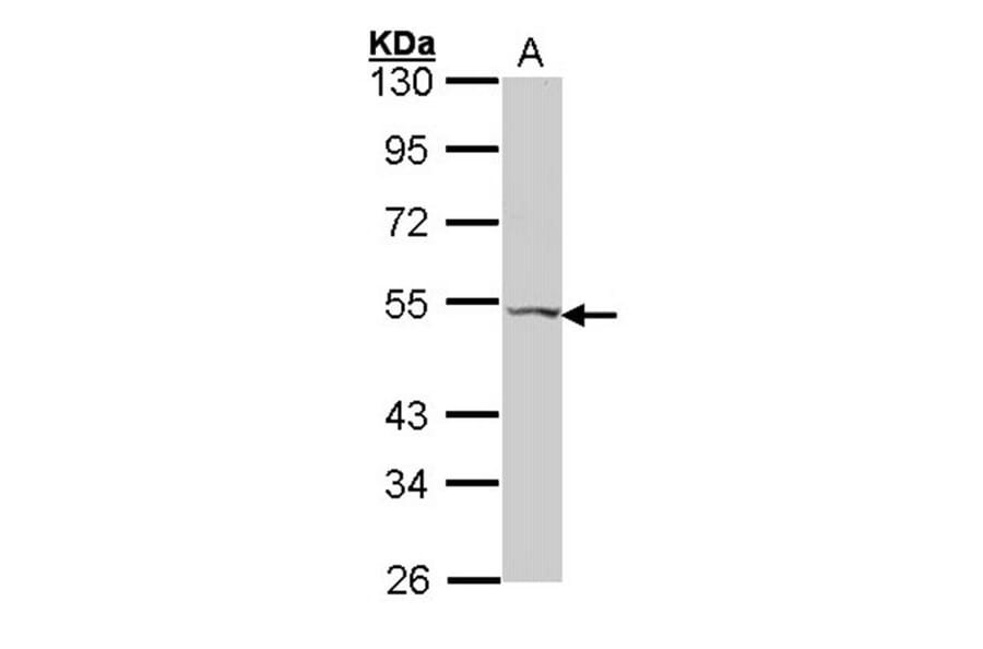 VPAC2 antibody from Signalway Antibody (22564) - Antibodies.com