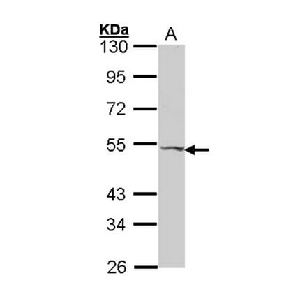 VPAC2 antibody from Signalway Antibody (22564) - Antibodies.com