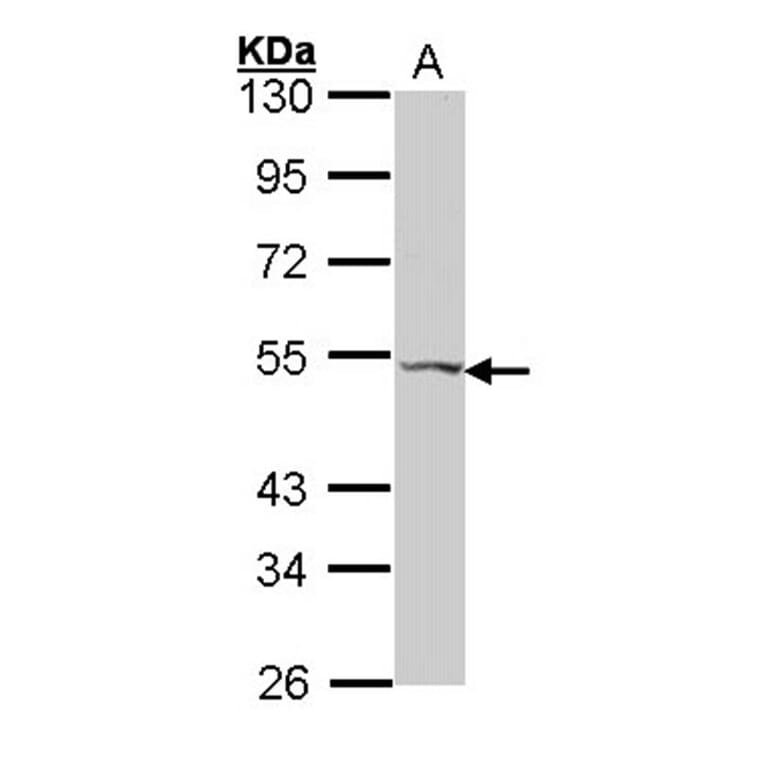 VPAC2 antibody from Signalway Antibody (22564) - Antibodies.com