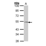 VPAC2 antibody from Signalway Antibody (22564) - Antibodies.com