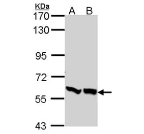 PFKFB3 antibody from Signalway Antibody (22584) - Antibodies.com