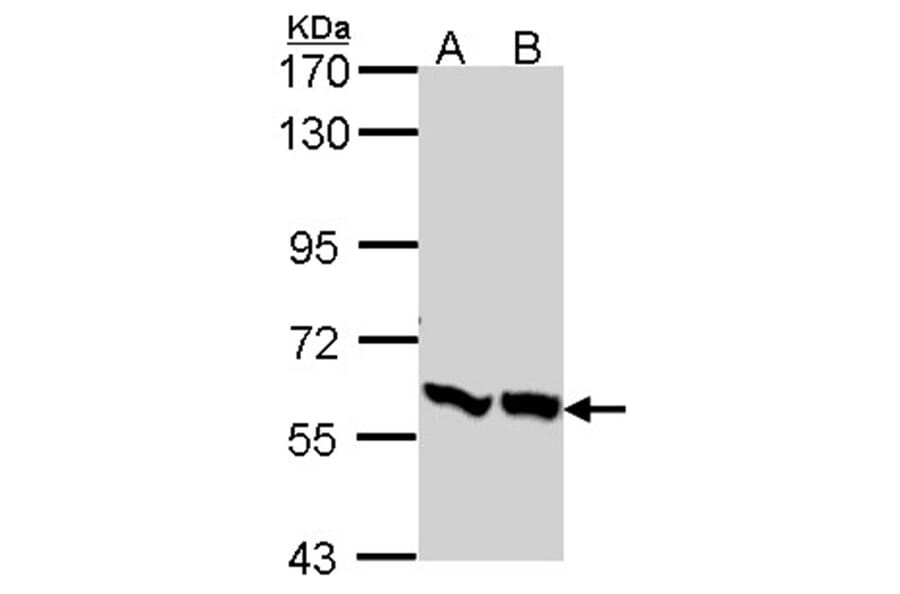 PFKFB3 antibody from Signalway Antibody (22584) - Antibodies.com