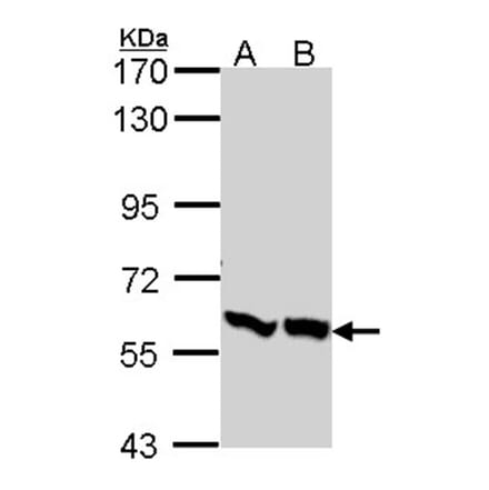 PFKFB3 antibody from Signalway Antibody (22584) - Antibodies.com