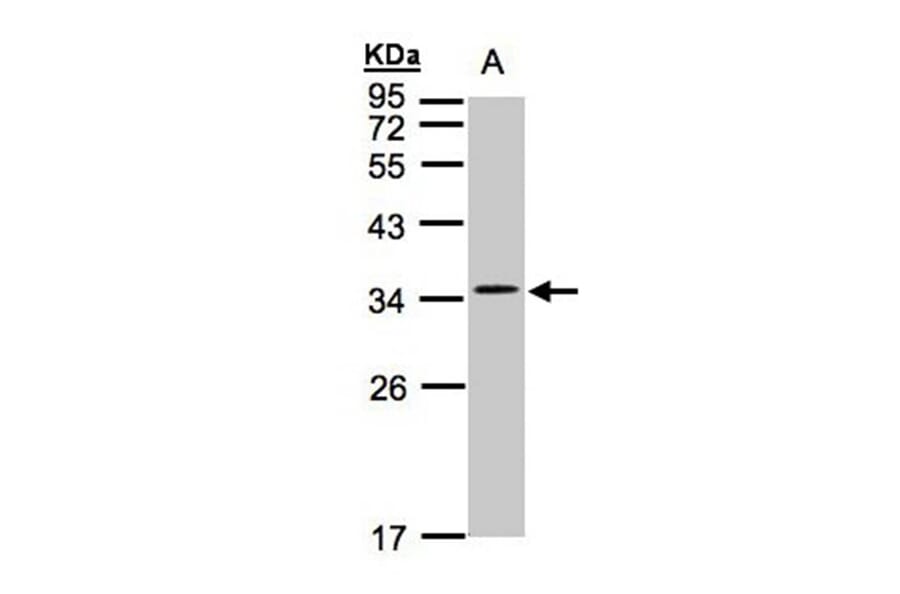 CACNG5 antibody from Signalway Antibody (22620) - Antibodies.com