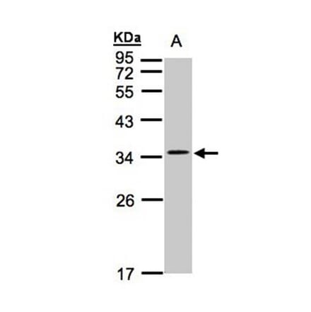 CACNG5 antibody from Signalway Antibody (22620) - Antibodies.com