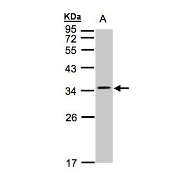 CACNG5 antibody from Signalway Antibody (22620) - Antibodies.com